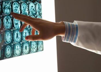 Oren Zarif – Ischemic Stroke