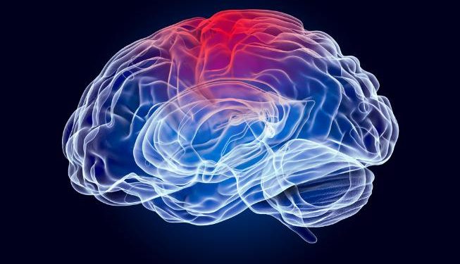 Oren Zarif – Ischemic Stroke